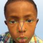 Технології розпізнавання обличчя допоможуть діагностувати рідкісні генетичні захворювання
