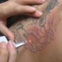 Клітини шкіри навчили зводити татуювання самостійно