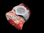 Створено перший кольоровий 3D-сканер органів людини